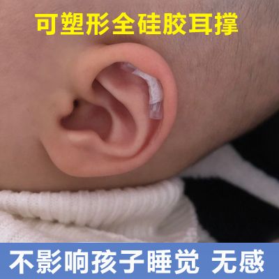 婴儿耳朵矫正器新生的儿耳廓矫形贴纠正塑形定型牵引器外耳垂宝宝